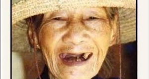 Bộ sưu tập "nụ cười hàng hiếm" 1 Bộ sưu tập “nụ cười hàng hiếm”