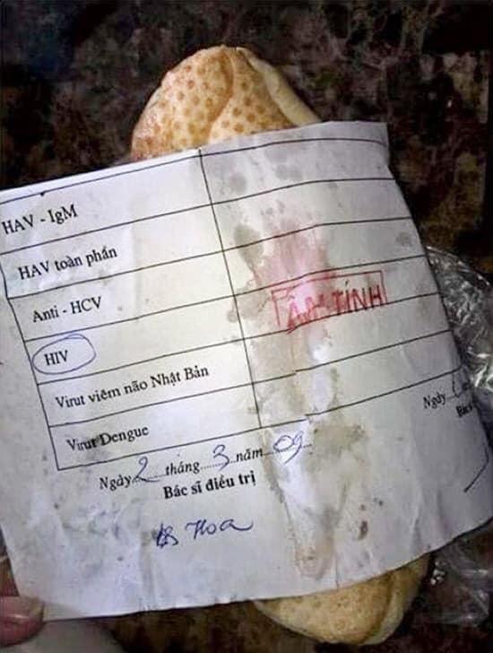 Nhập viện sau khi ăn bánh mì 8 Nhập viện sau khi ăn bánh mì